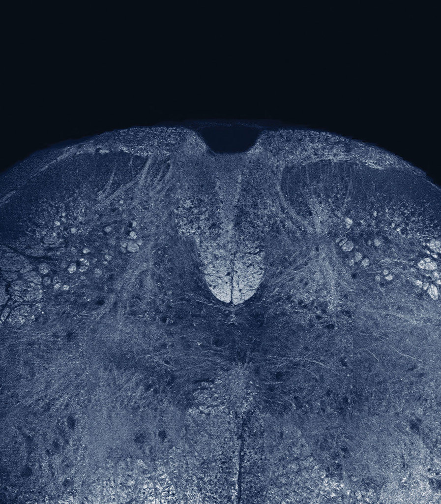 THG image of myelin thumbnail