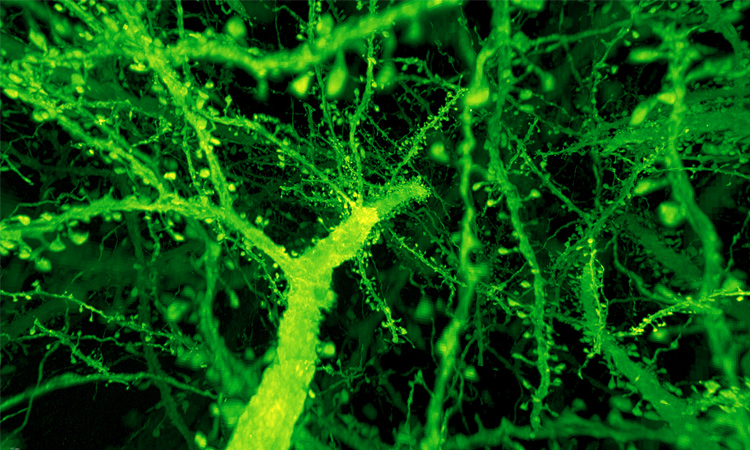 Image of expanded neurons