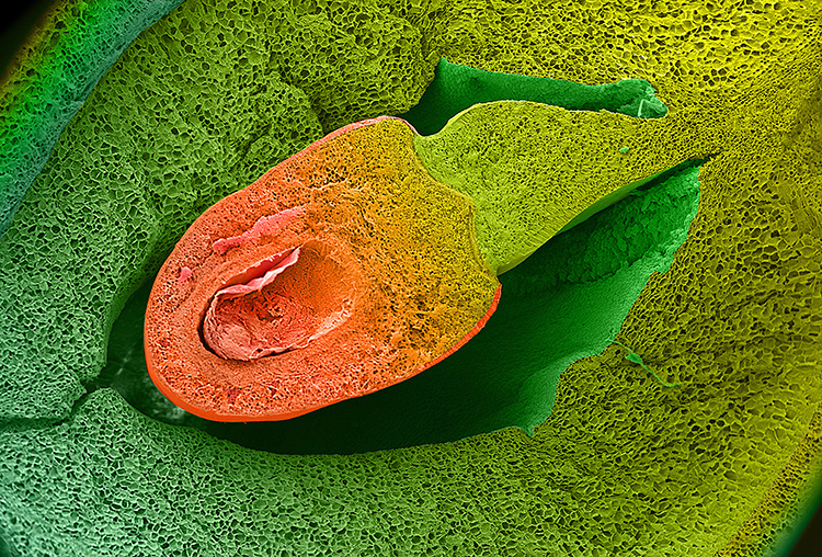 Cross-Section Through a Bean 