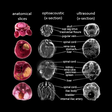 anatomical, optoacoustic and ultrasound image slices