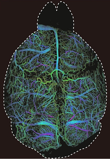 mouse brain image using DOLI