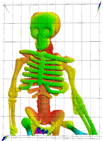optical image of skeleton model