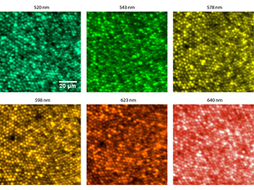 six retinal micrographs at different wavelengths