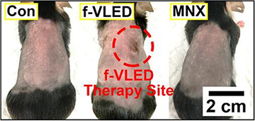 mice with shaved backs, showing control, LED and minoxidil treatment