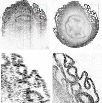 photomicrographs comparing techniques