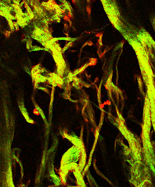 Second Harmonic Generation And Endogenous Fluorescence  thumbnail